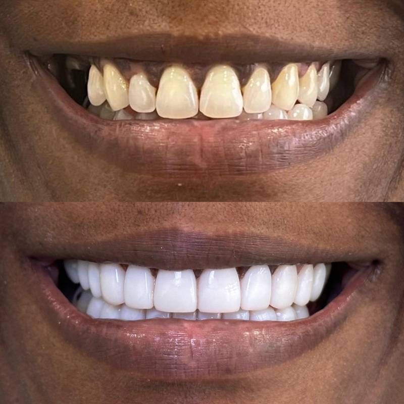 Dental Smile Design near me