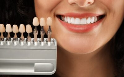 Smile Design vs Veneers: Which One Is Right for You?