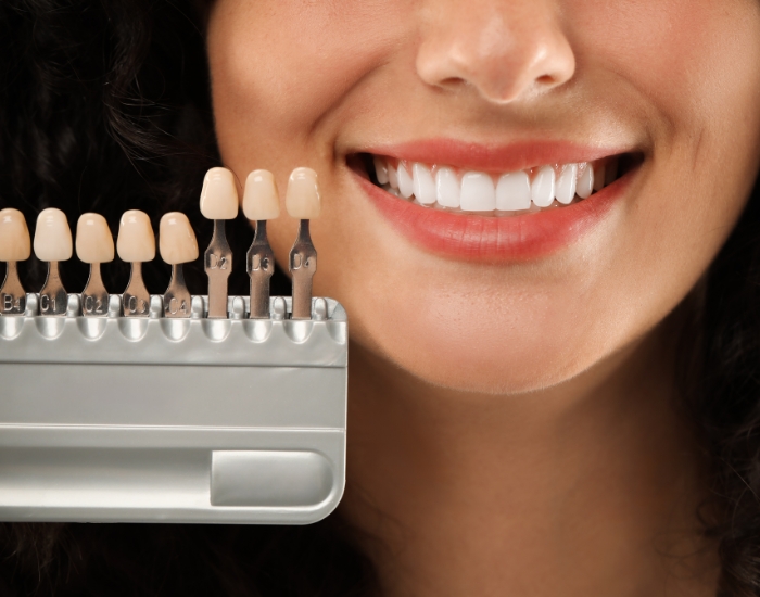 Smile Design vs Veneers: Which One Is Right for You?