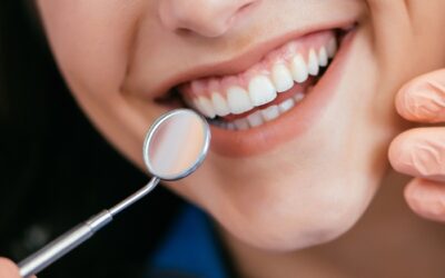 Smile Design Aftercare: How to Keep Your Perfect Smile Bright