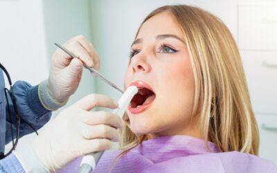 Top 5 Reasons Patients Choose Smile Design in Miami