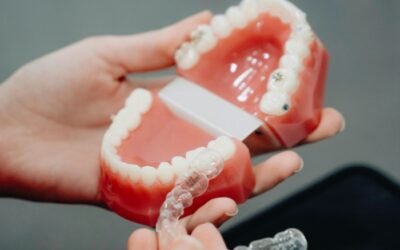 How Much for a Replacement Retainer: Costs, Options, and Tips