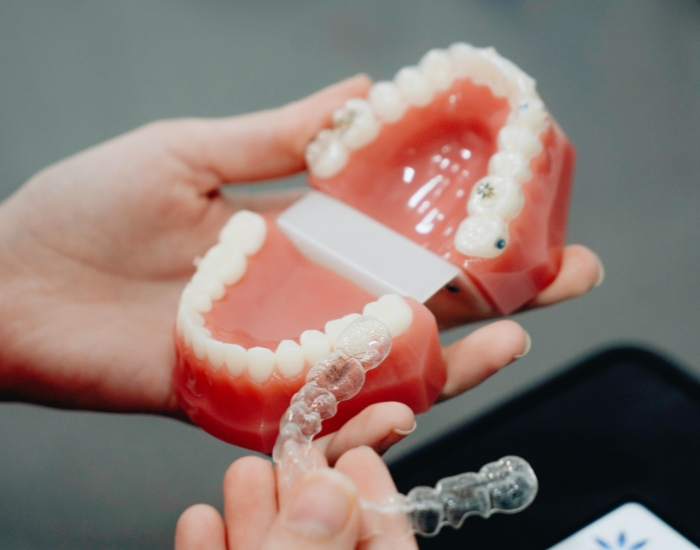 How Much for a Replacement Retainer: Costs, Options, and Tips