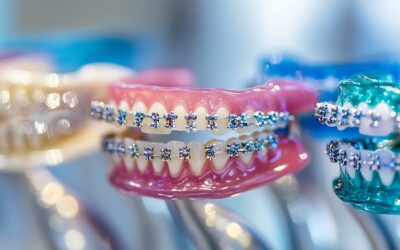 Foods You Can’t Eat with Braces: What to Avoid and Why