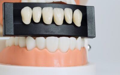 Veneer Teeth Cost: What Affects the Final Amount